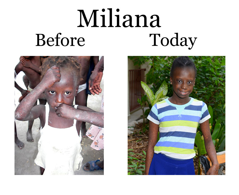 Update on Miliana:  6-24-18  7:15 PM