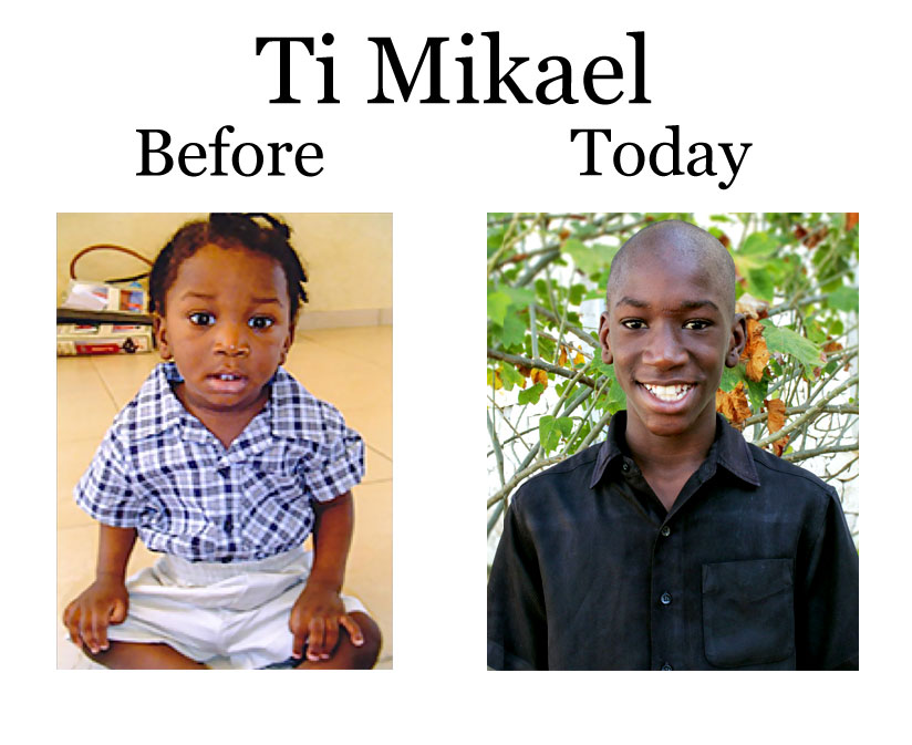 Update on Ti Mikael:  6-27-18  8:00 PM