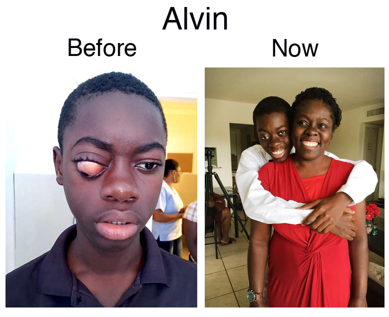 Alvin Update – 07-02-18 – 7 PM