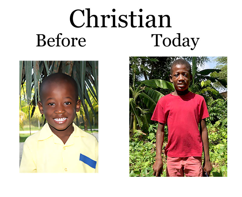 Update on Christian: 8-1-18  7:00 PM