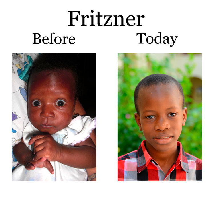 Update on Fritzner:  7-17-18  8:00 PM