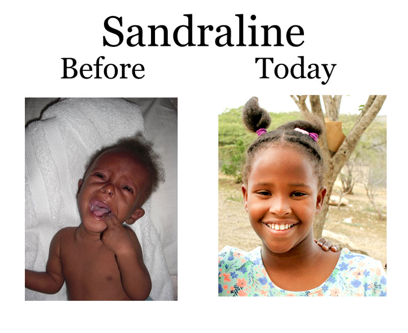 Update on Sandraline:  7-22-18  6:15 PM