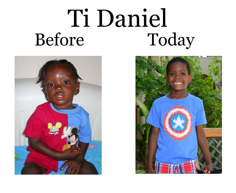 Update on Ti Daniel:  7-7-18   8:00 PM