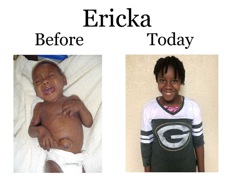 Update on Ericka