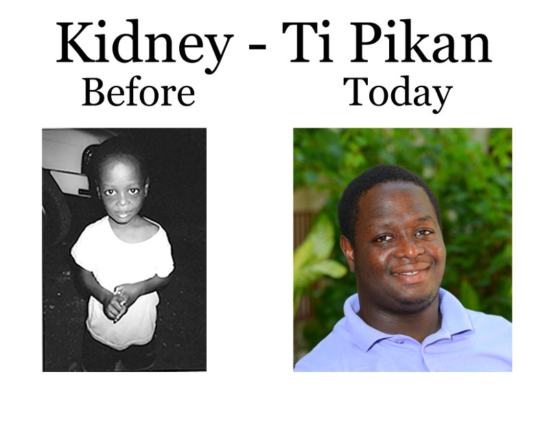 Update on Kidney – Ti Pikan:  8-10-18   7:00 PM