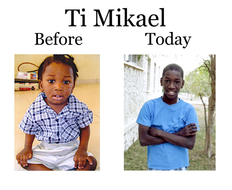 Update on Ti Mikael:  8-28-18  8:00 PM