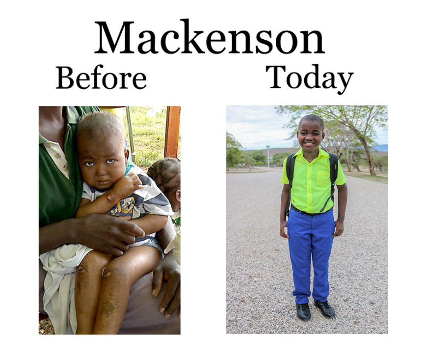 Mackenson Update