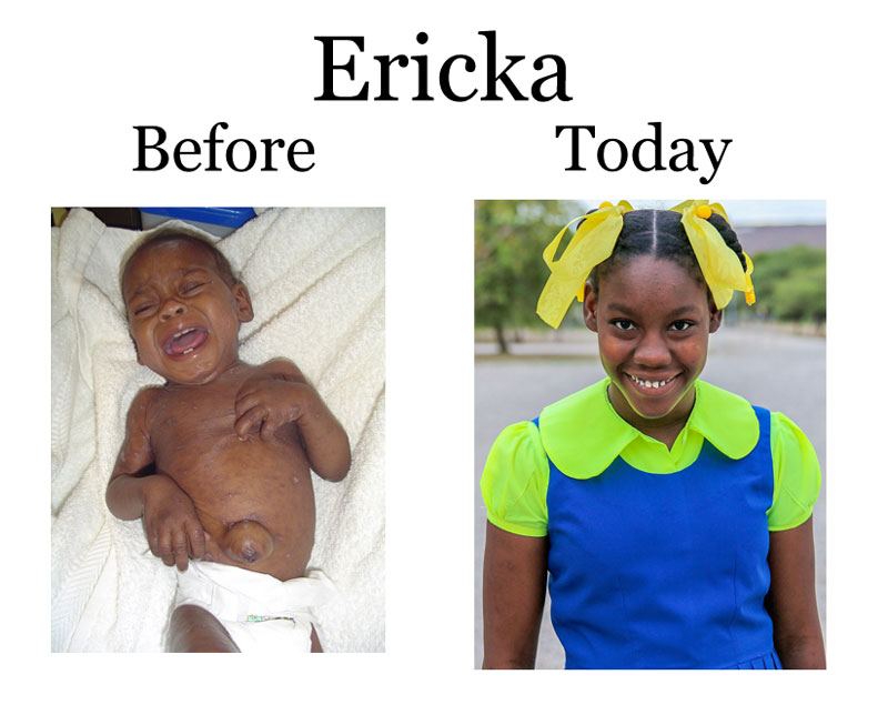 Update on Ericka: 10-13-18  6:00 PM