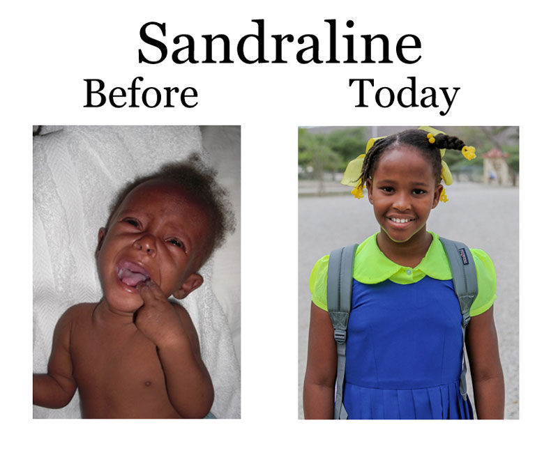 Update on Sandraline: