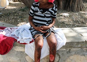 A poor young girl waits for medical care at Love A Child.