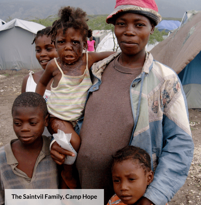 The earthquake in 2010 left thousands of families without homes. Pictured in the center, Marie Ange was badly burned.