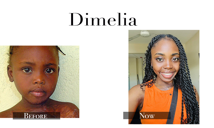 Dumolia… Our Baby!