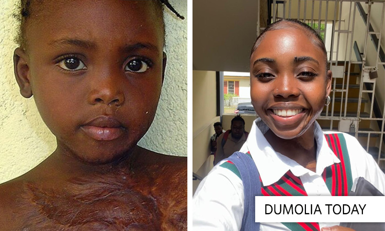 Dumolia… “An Amazing Young Lady”