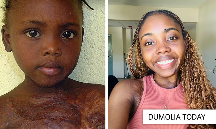 Dumolia – Doing Great in Jamaica!