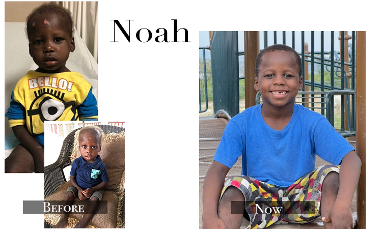 Noah, Looks Like You’re Missing Some Teeth!