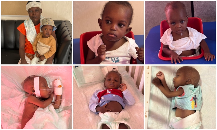 Our Malnutrition Clinic… Still Saving Little Lives!
