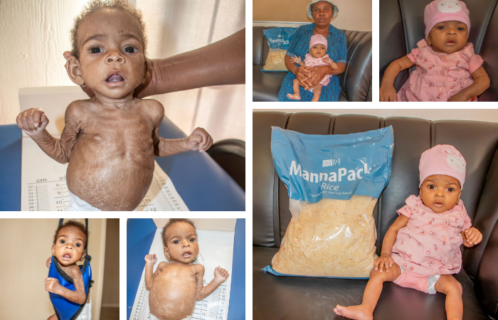 Malnutrition Center: