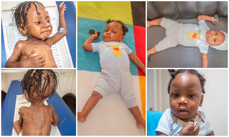 Baby Geome’s Heart-Warming Story